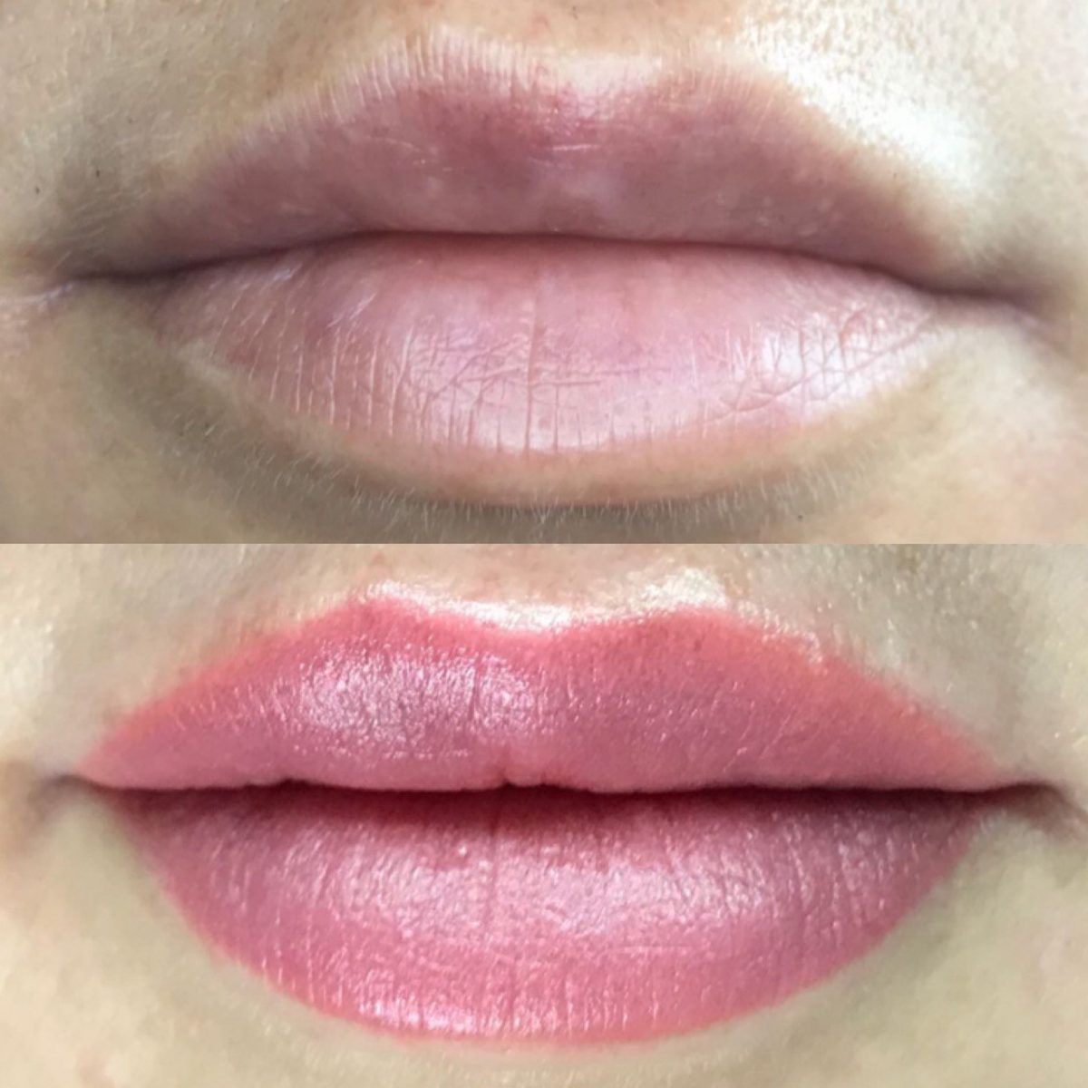 Skindex – Etalon-pmu.ru