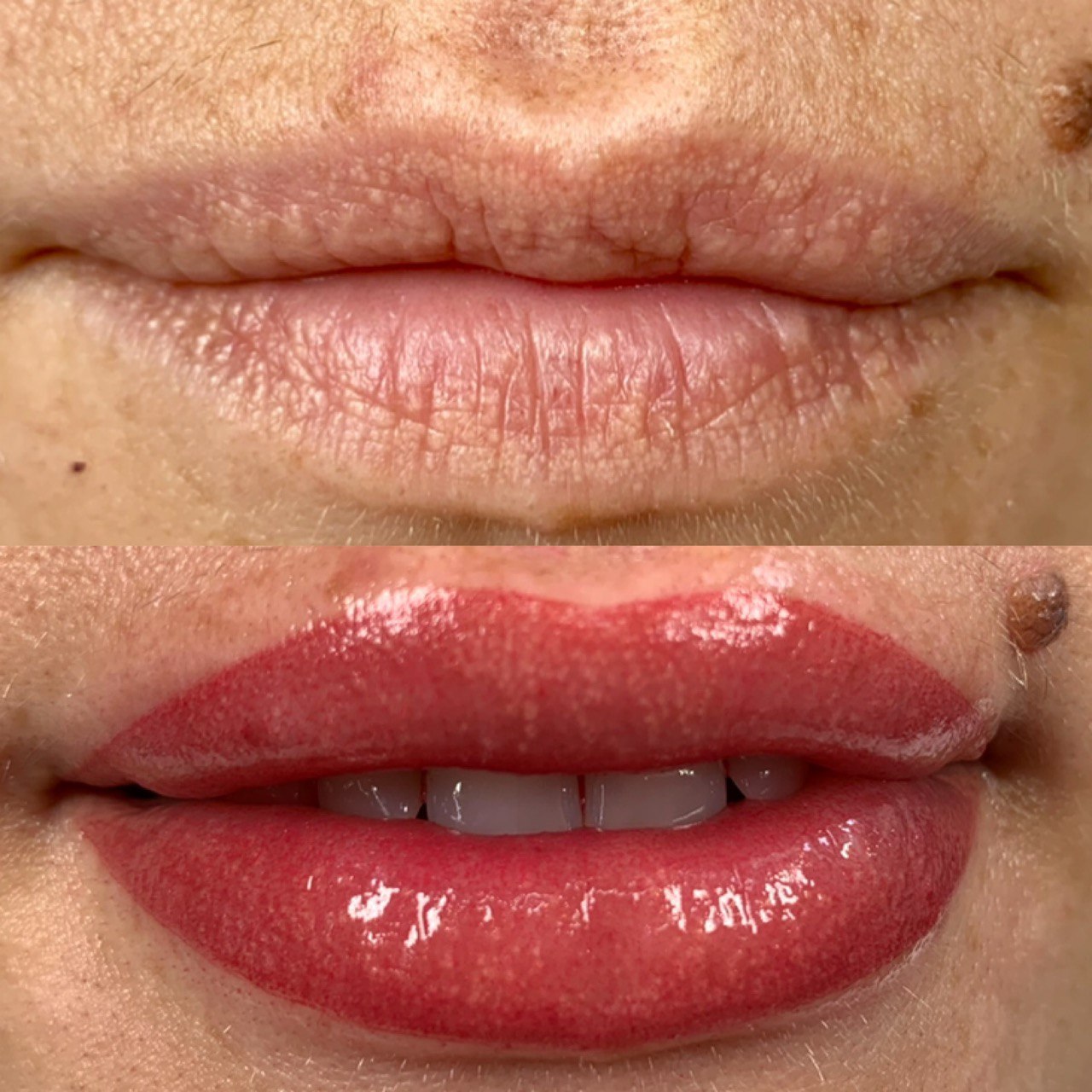 Skindex – Etalon-pmu.ru