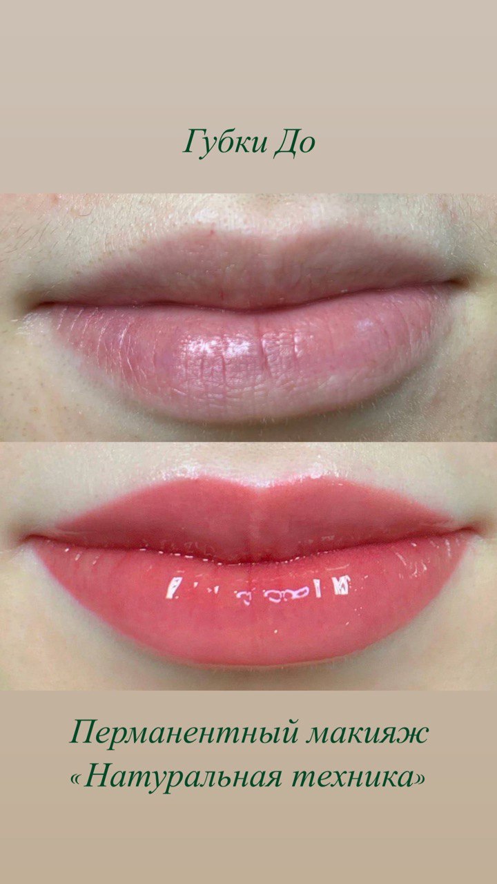 Skindex – Etalon-pmu.ru