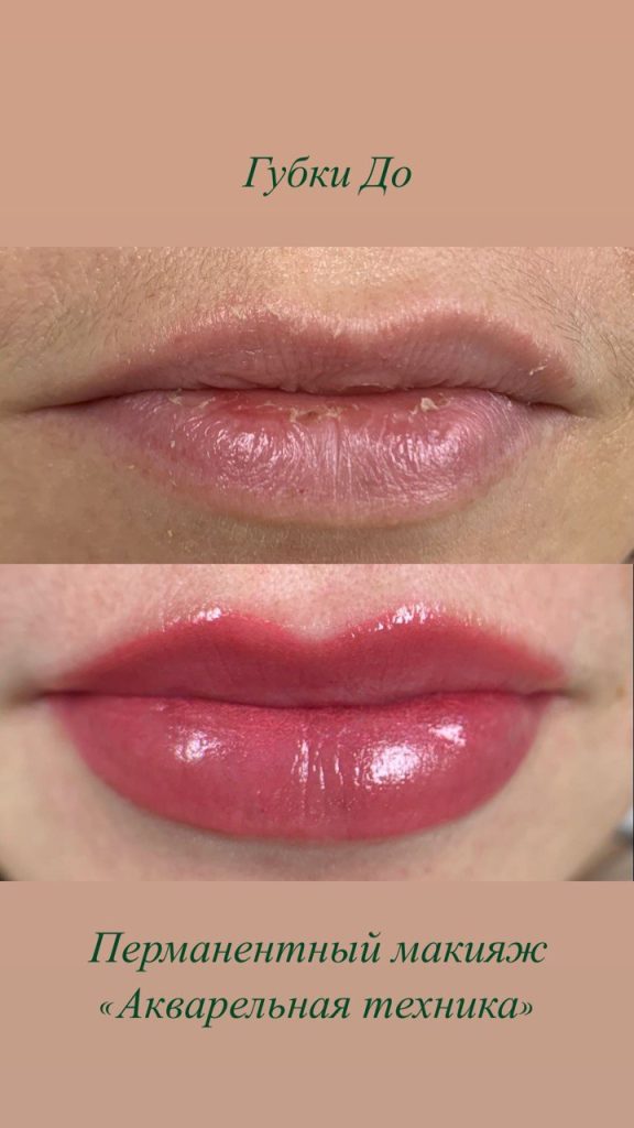 Skindex – Etalon-pmu.ru