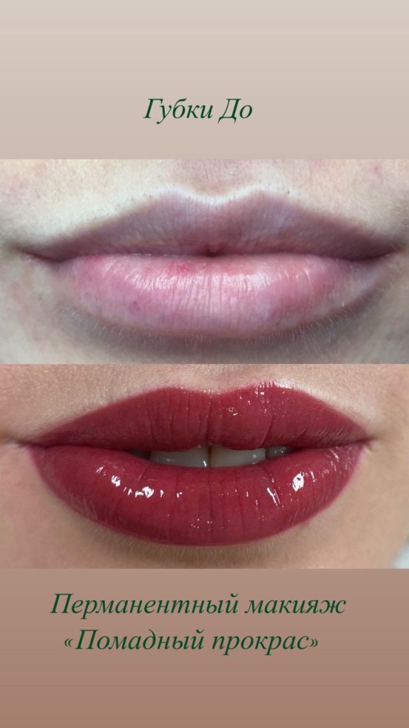 Skindex – Etalon-pmu.ru