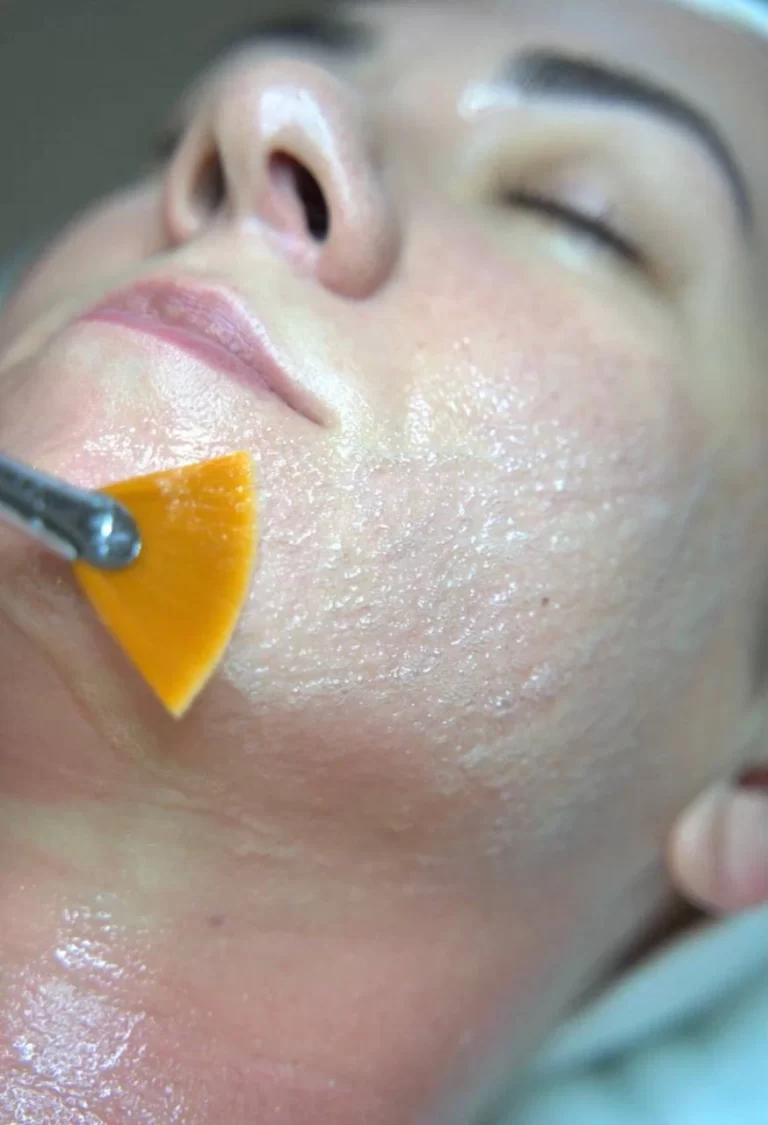 karboksiterapiya_6 Карбокситерапия