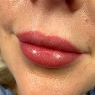 Pudrovie-gubi-742-700